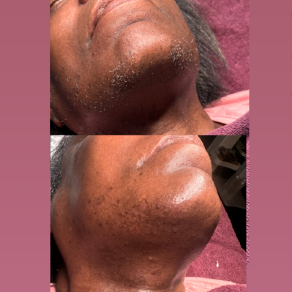 Full Face Wax