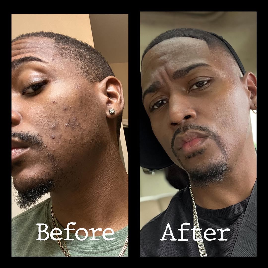 Our work, The Skin Trap Spa