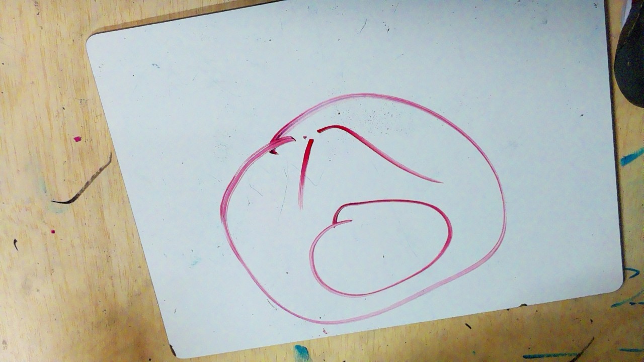 Frame 106