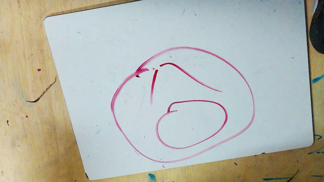 Frame 115