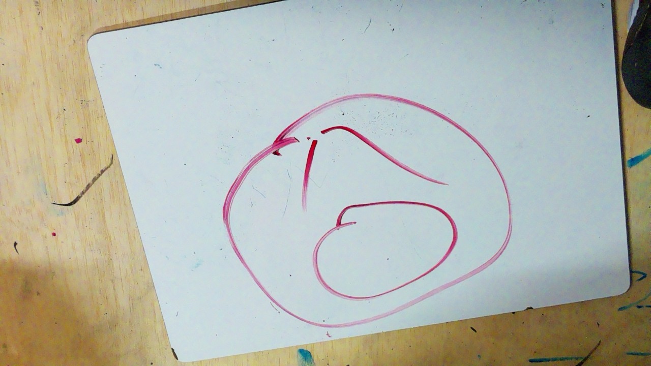 Frame 118