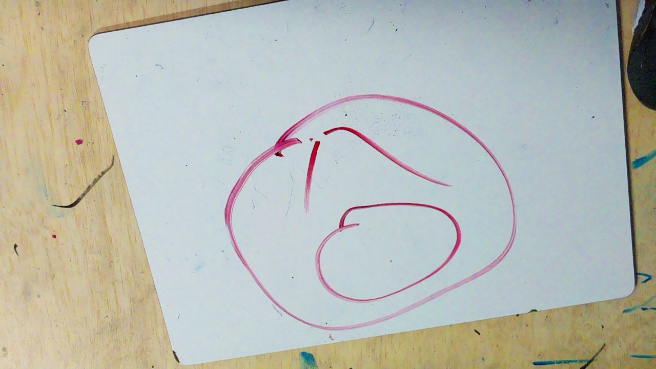 Frame 156