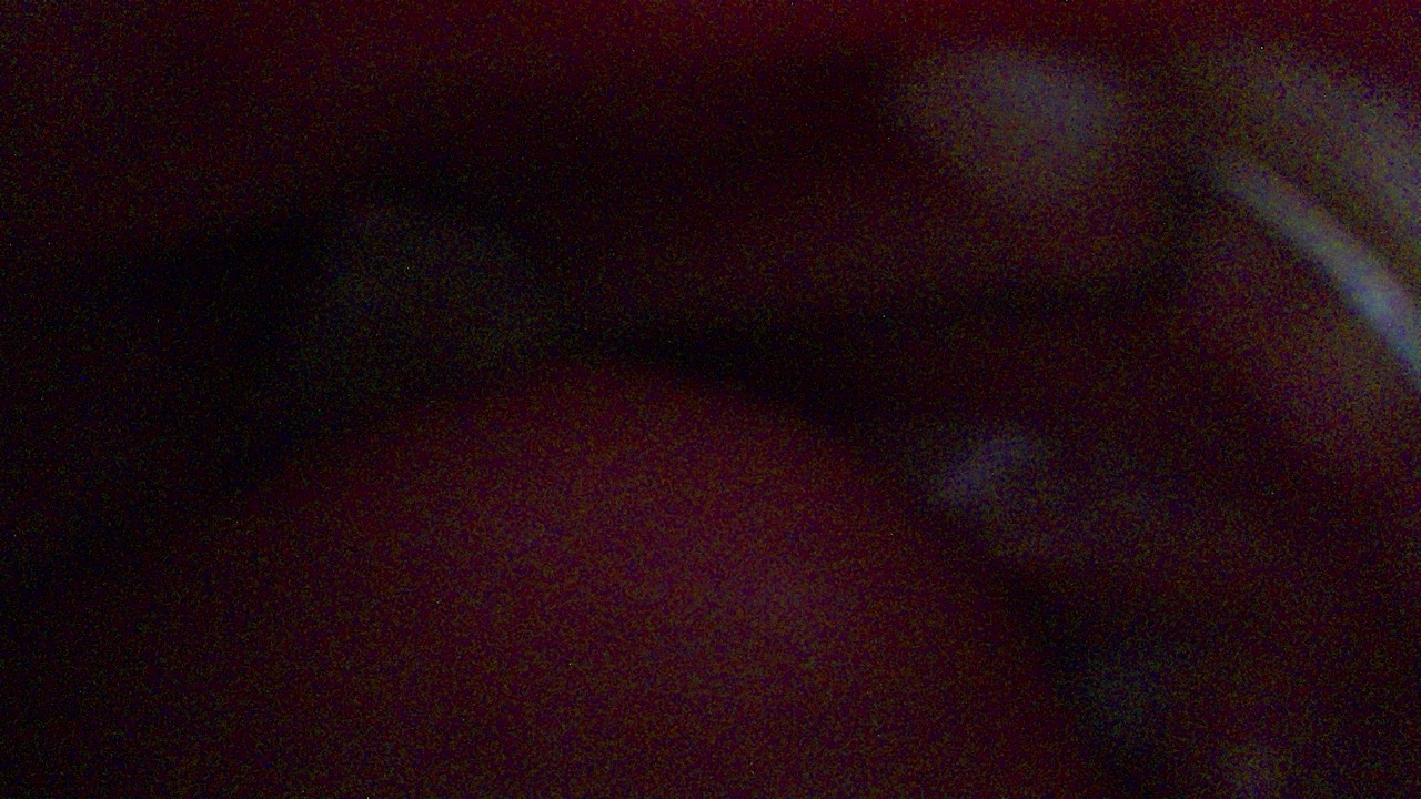Frame 100