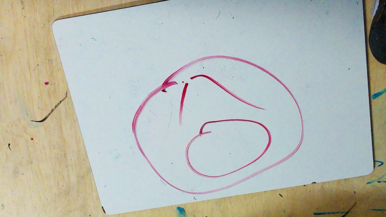 Frame 125