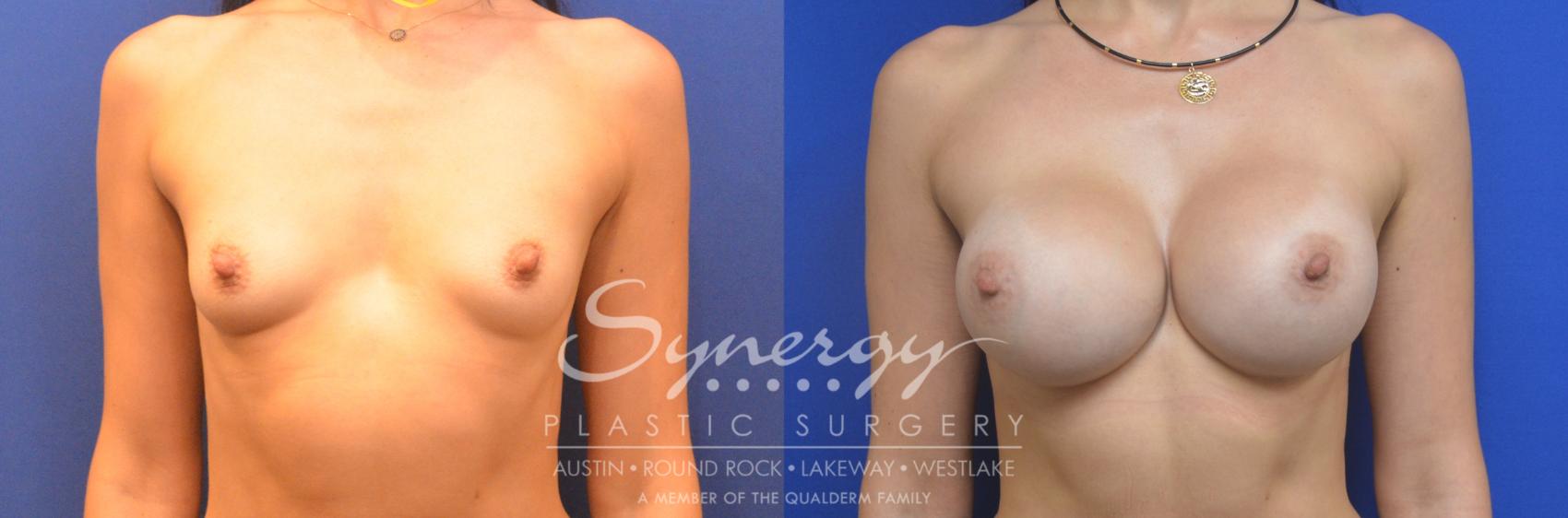 Synergy Plastic Surgery