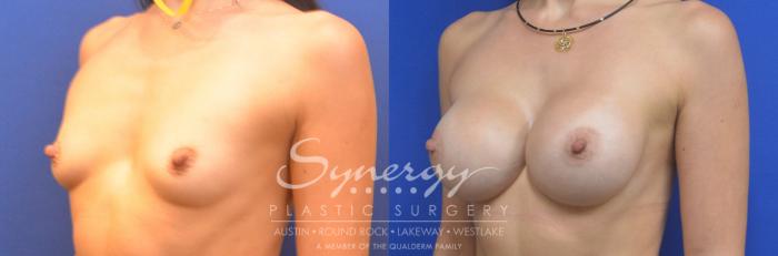 Synergy Plastic Surgery