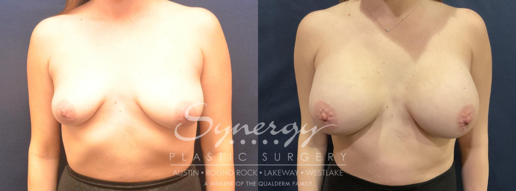 Synergy Plastic Surgery