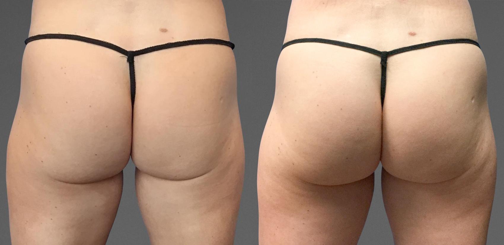 Before & After  Case 784 View #1 View in Austin, TX