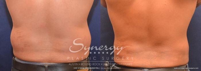 Before & After  Case 713 View #5 View in Austin, TX