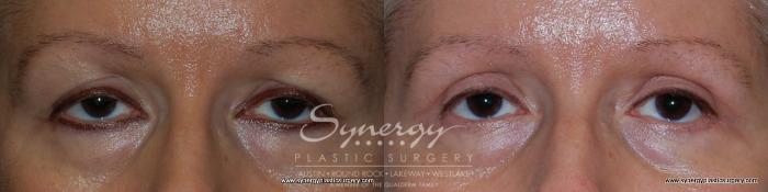 Before & After  Case 194 View #5 View in Austin, TX