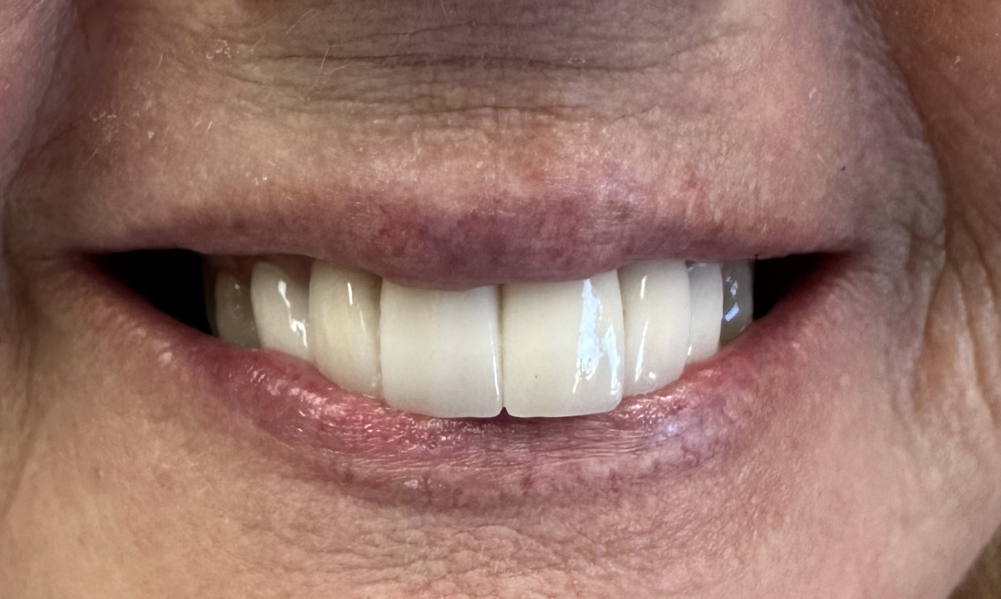 teeth