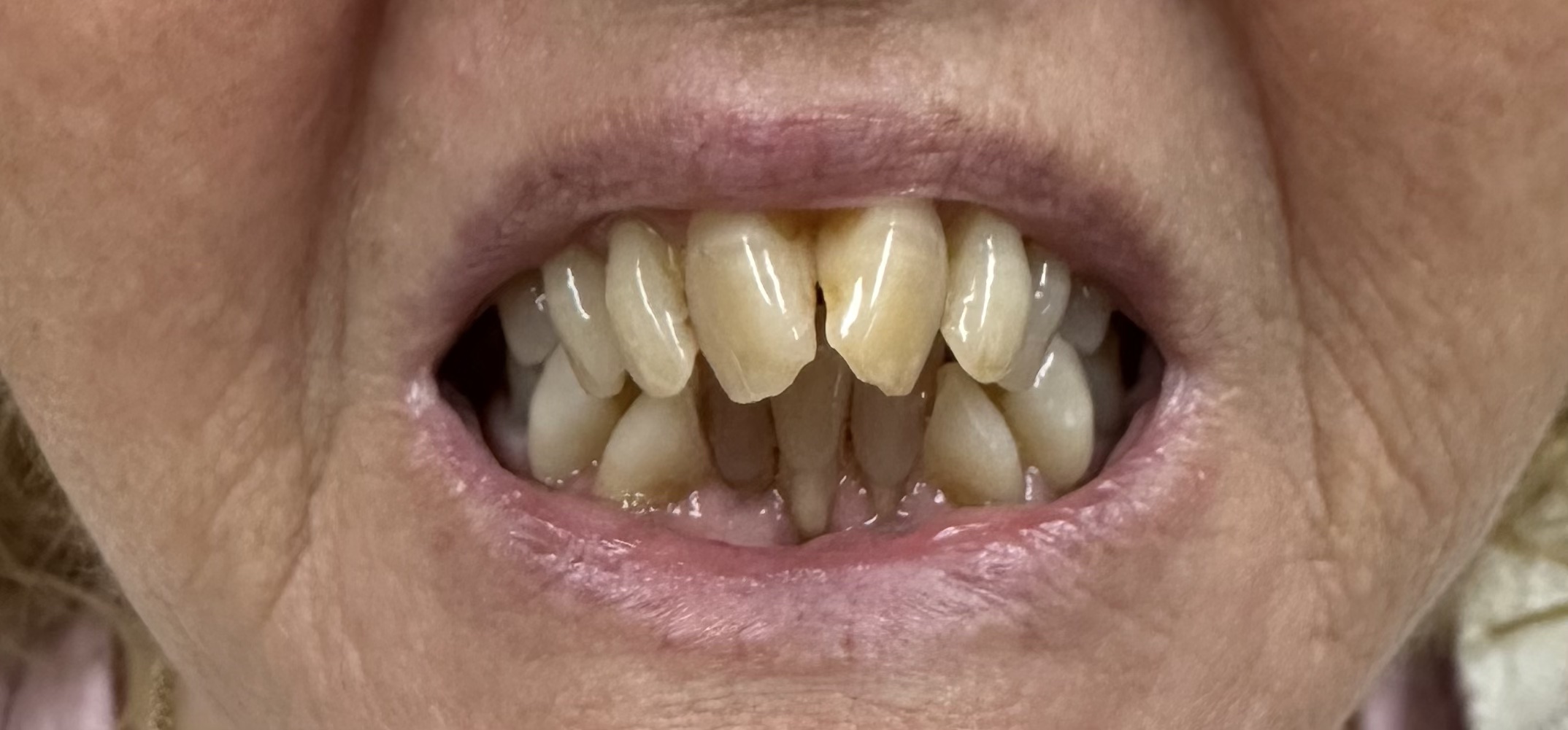 teeth