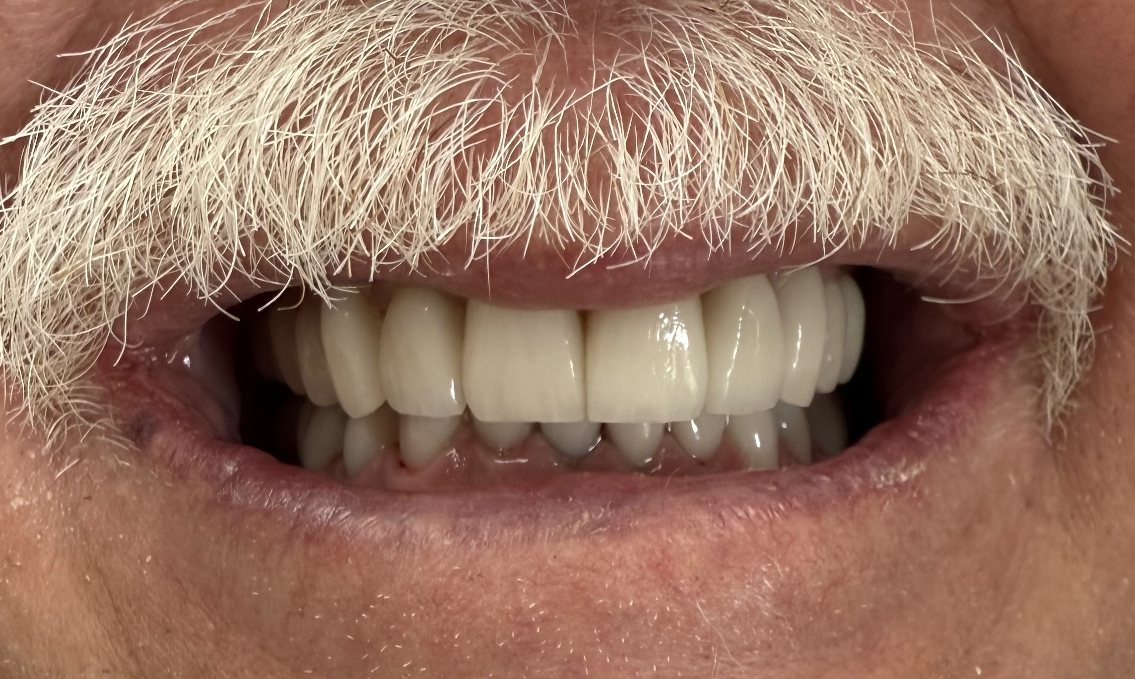 teeth
