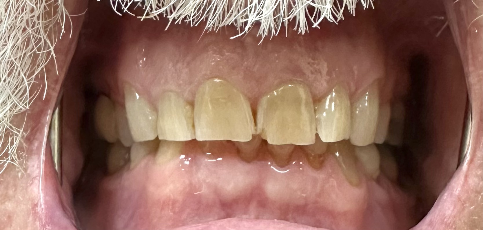 teeth
