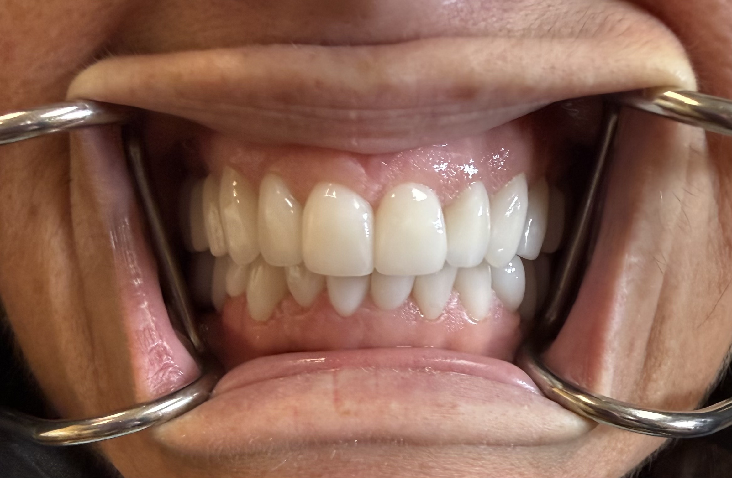 teeth