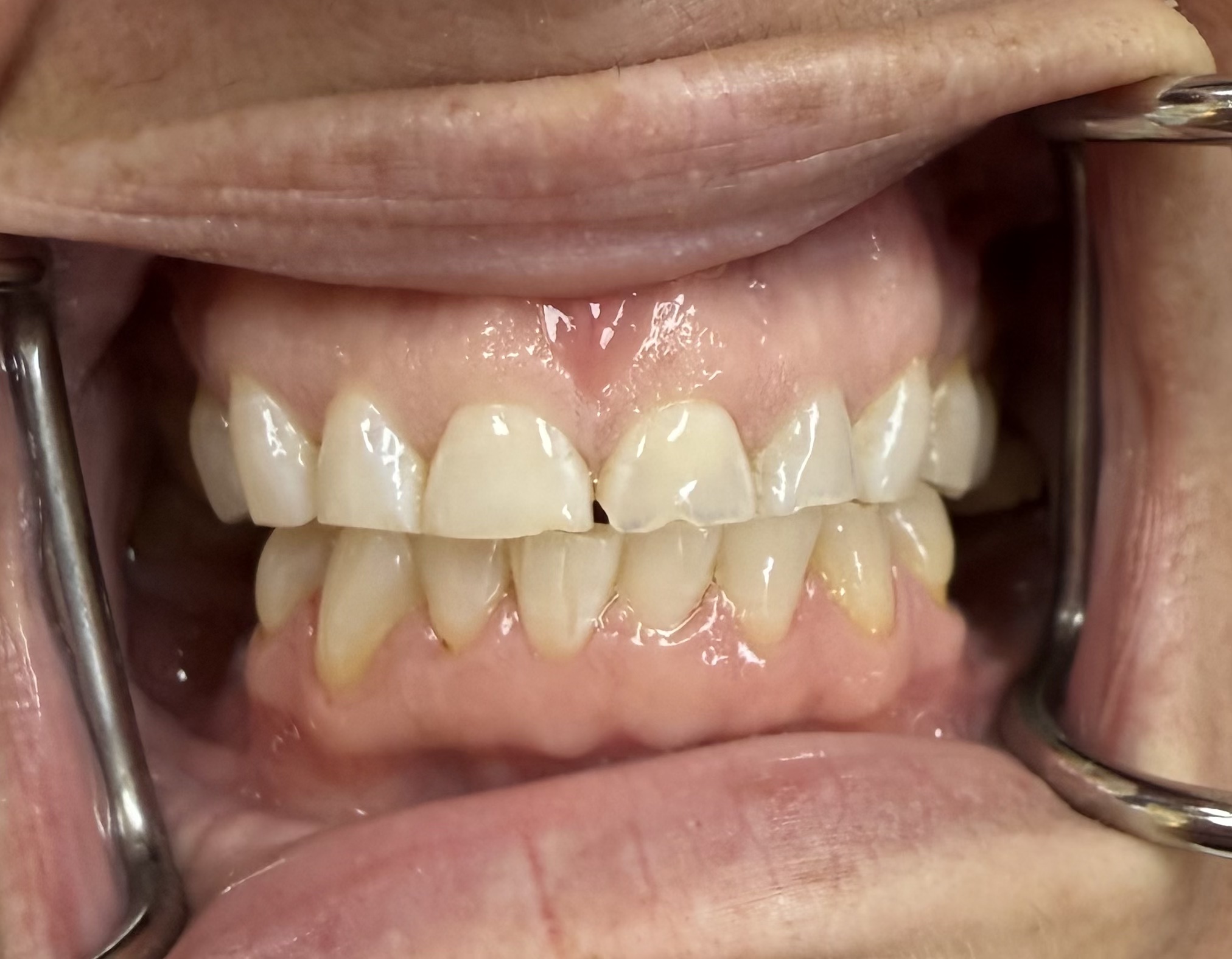 teeth