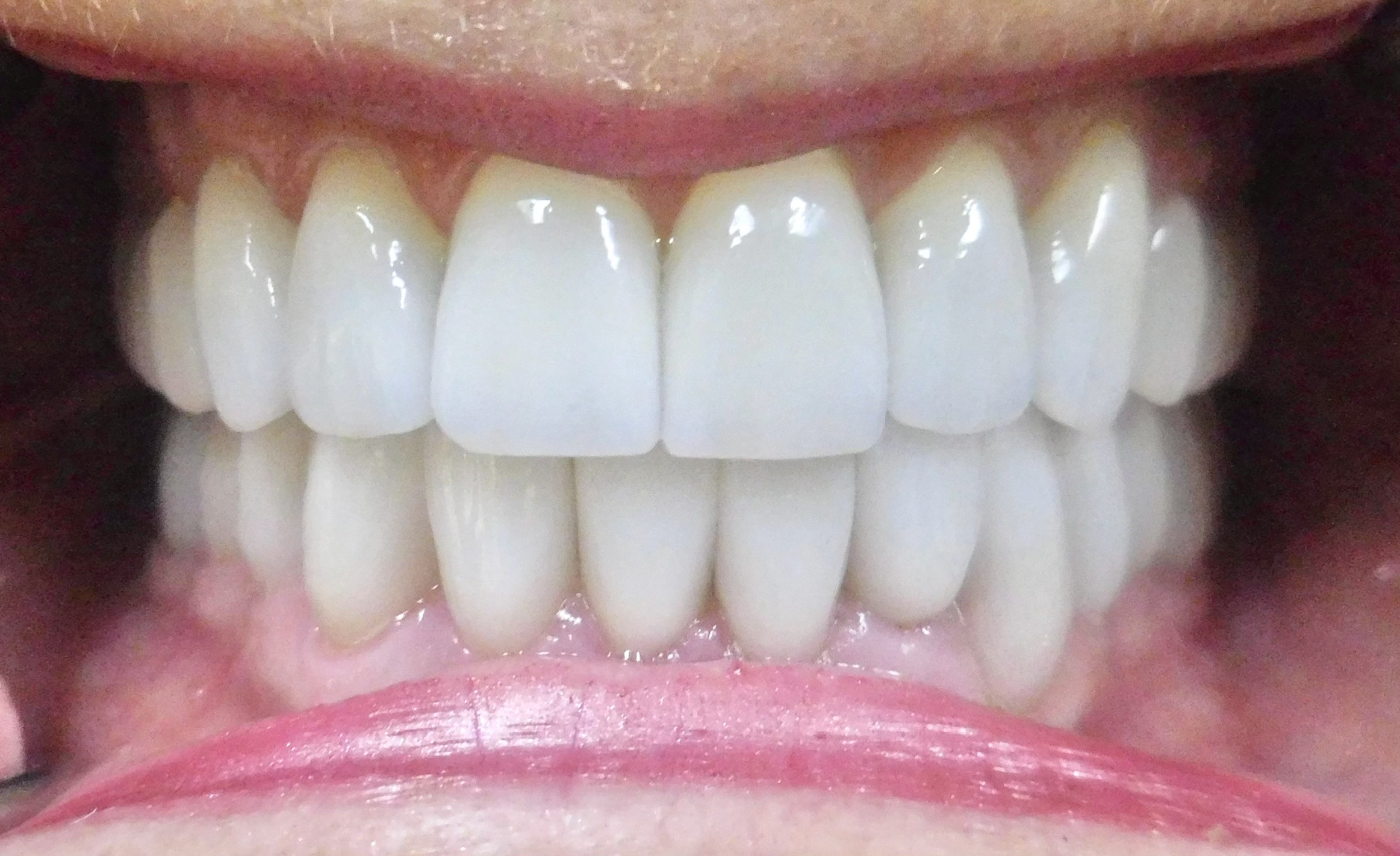 teeth