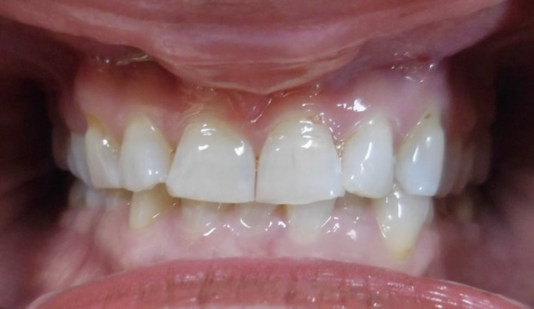 teeth