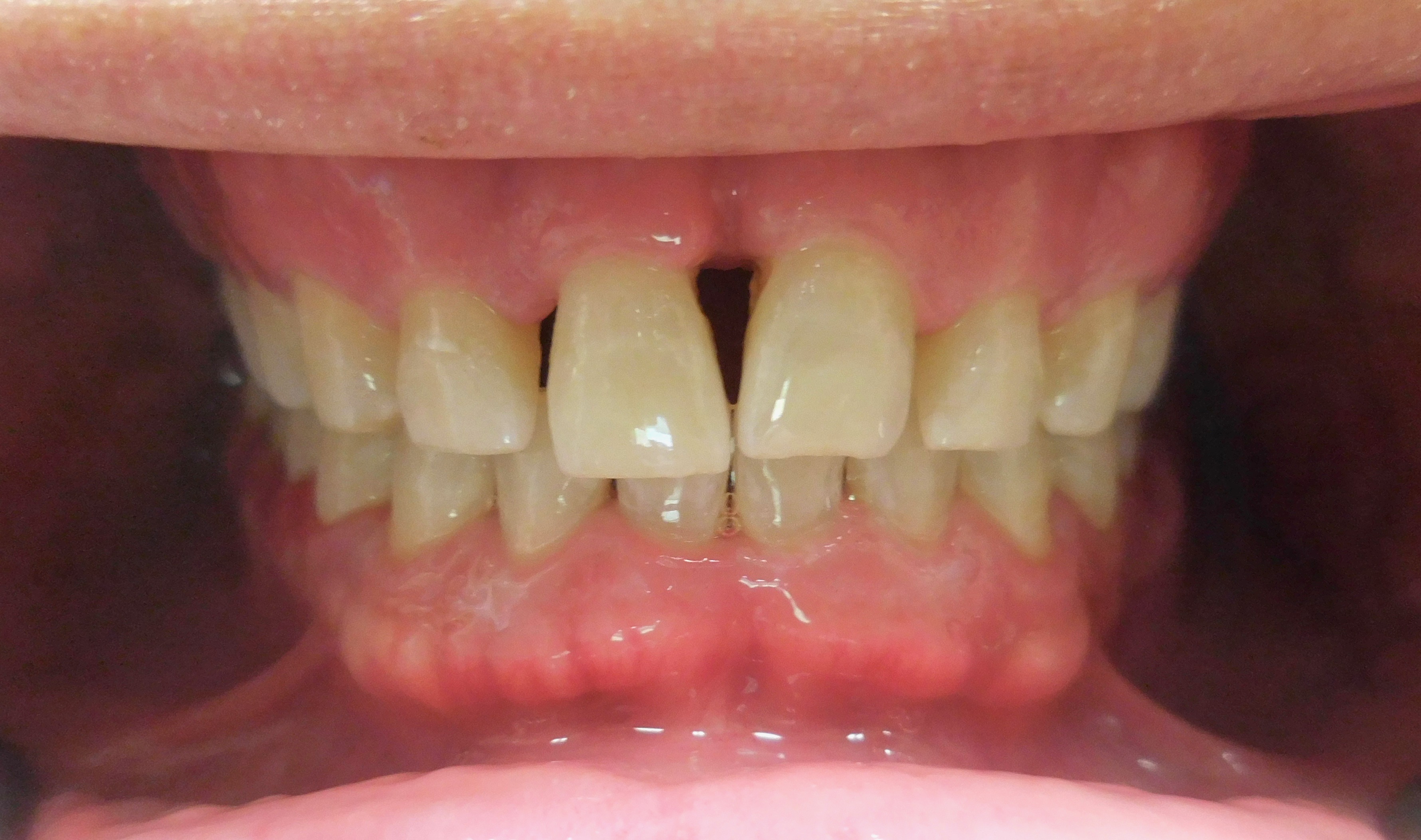 SK case Study 2 Before