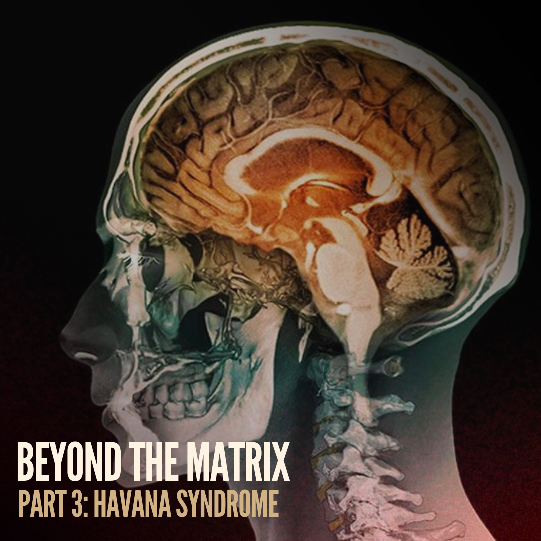 Havana Syndrome