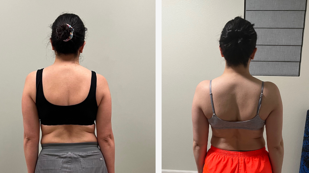 Your Step-by-Step Roadmap to a Pain-Free Body