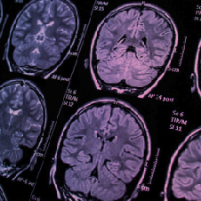 Imagem do post É possível acabar com os fogachos da menopausa?