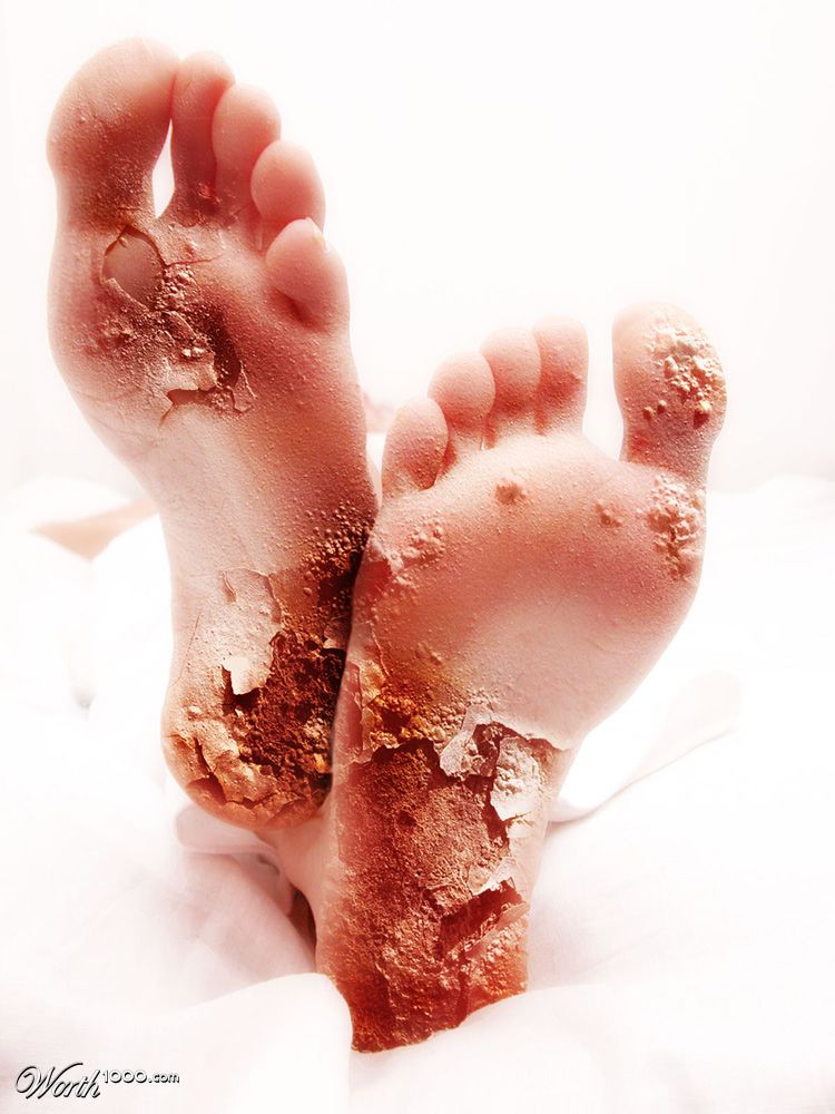 rusty feet