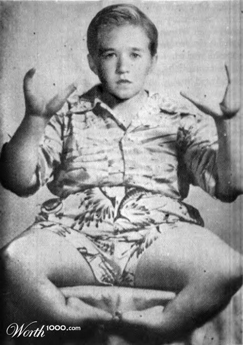 Haley "Lobsterboy" Osment