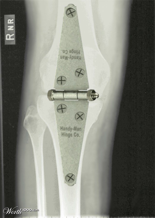 Knee Repair