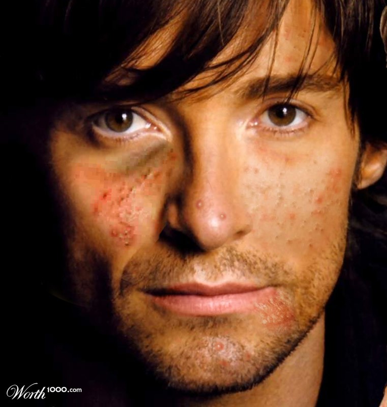 Hugh Jackman