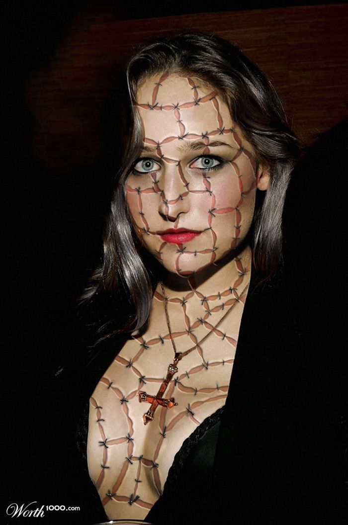 Stitches Sobieski