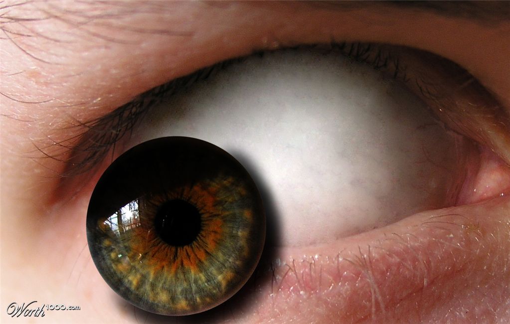 pupil levetation