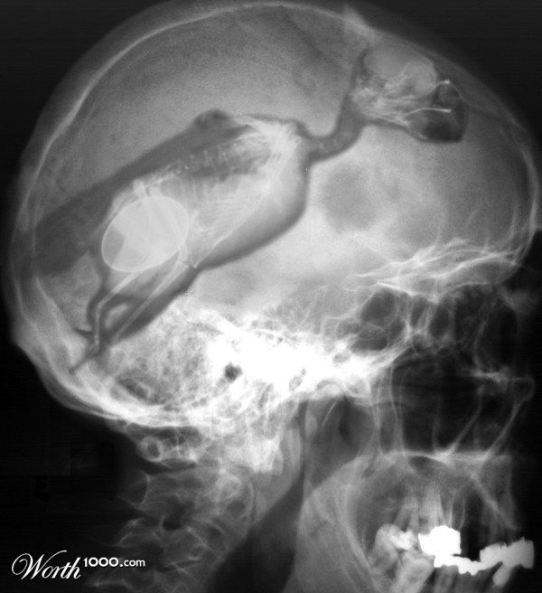 Bird Brain