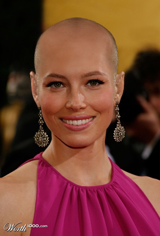 Bald Biel