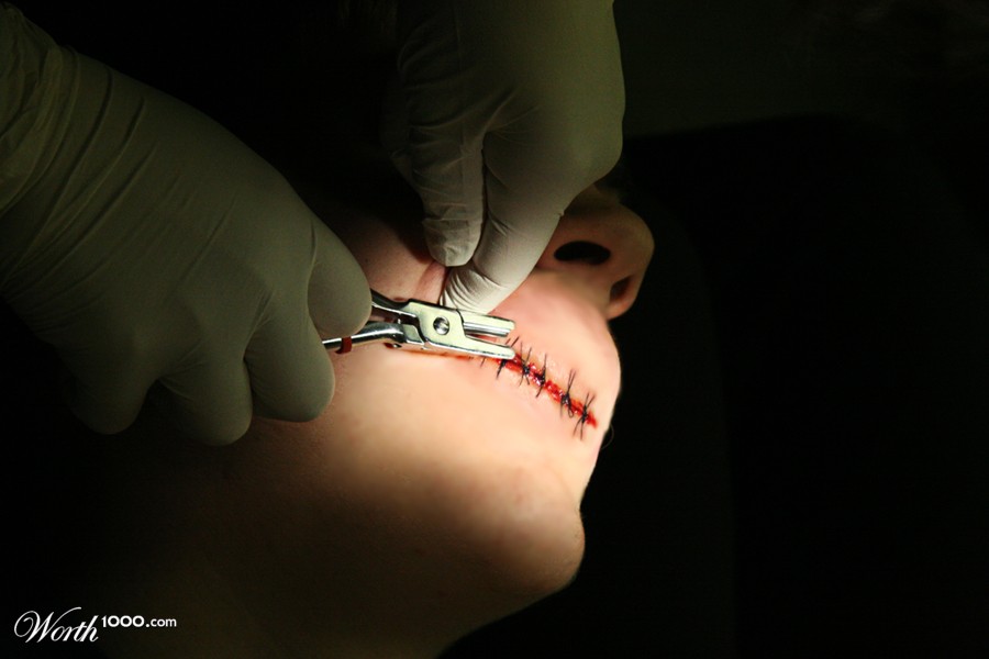 Stitched Mouth