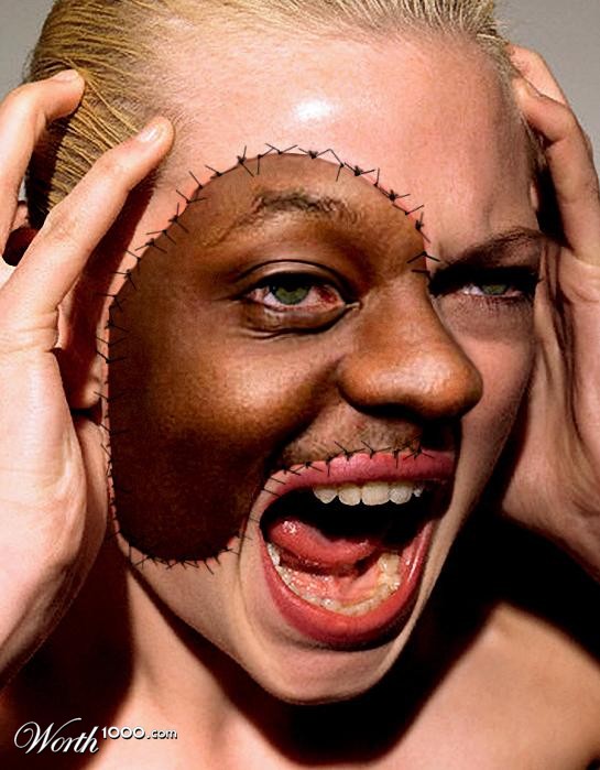 Face transplant