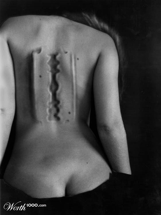 Back Pain