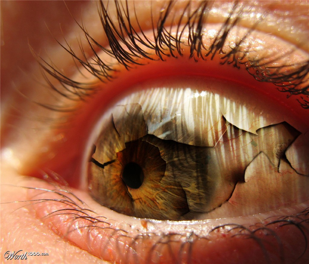 "Dry Eye's"