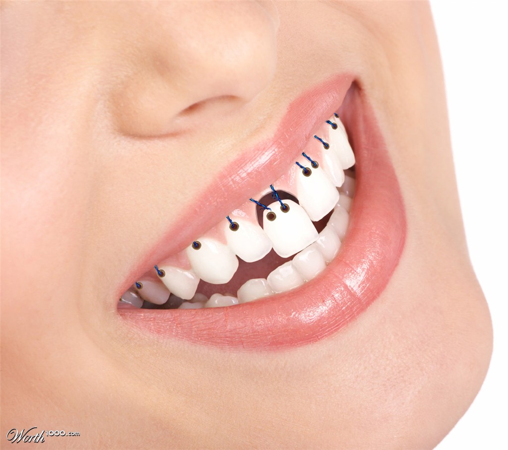 Teeth
