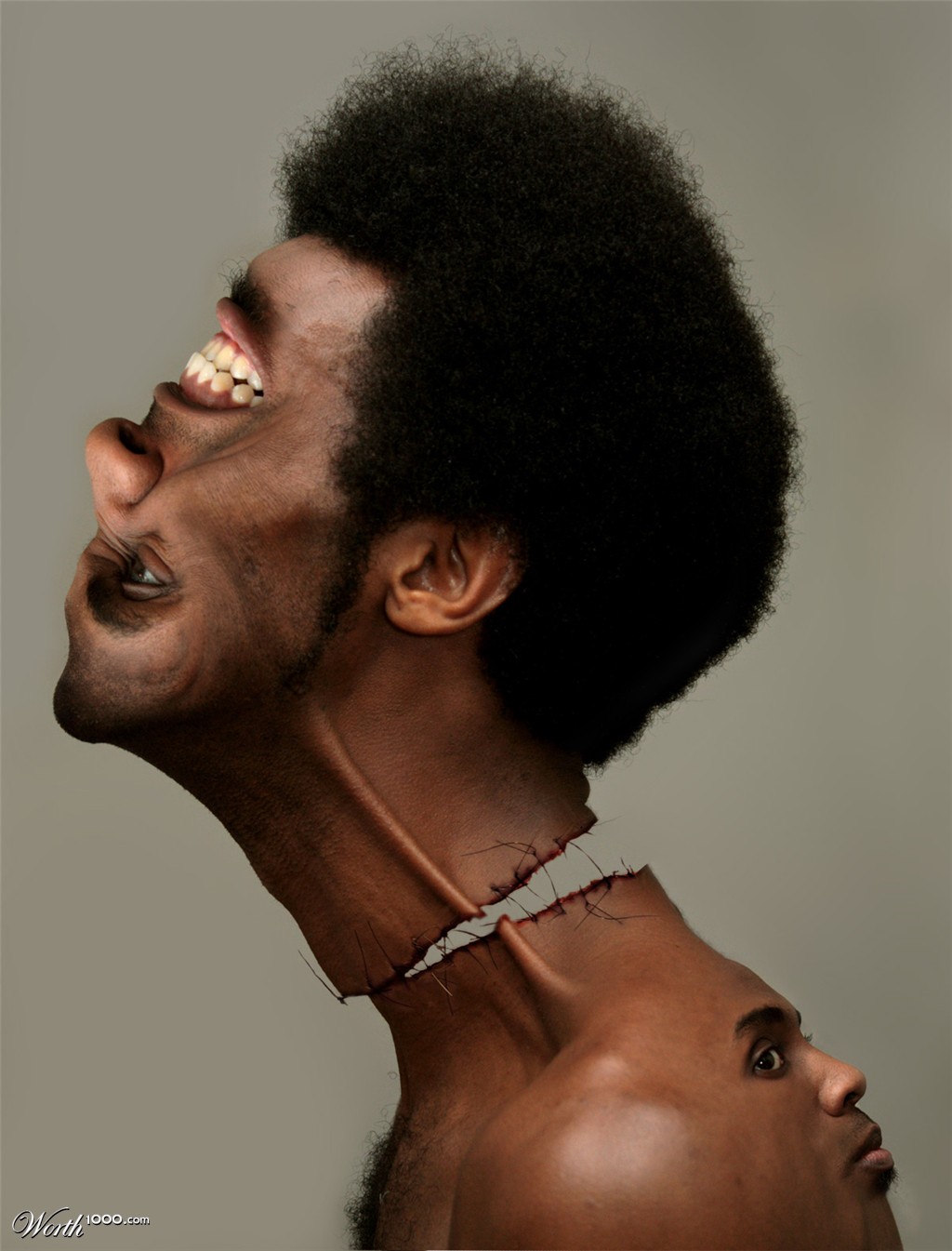 Face transplant failure