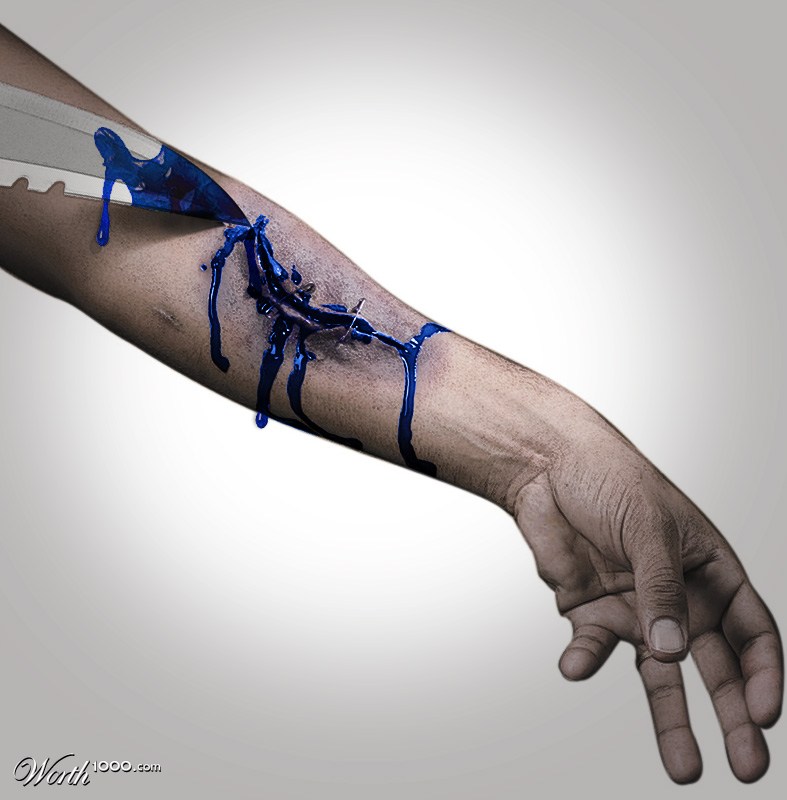 Bloody arm