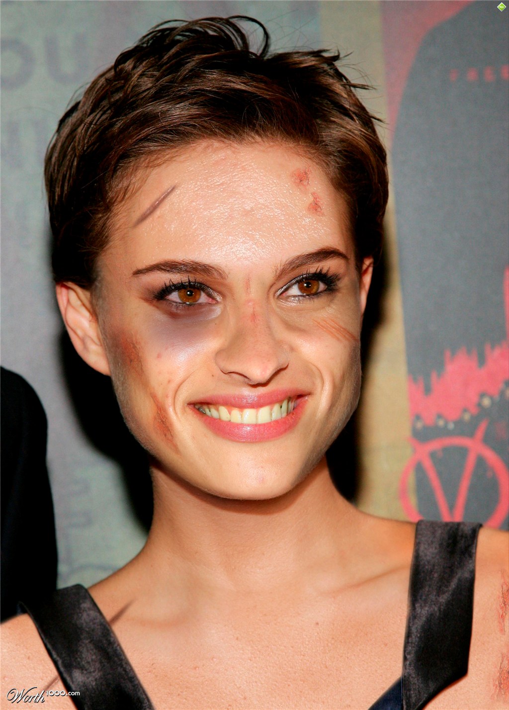 Nathalie Portman Survived An Accident