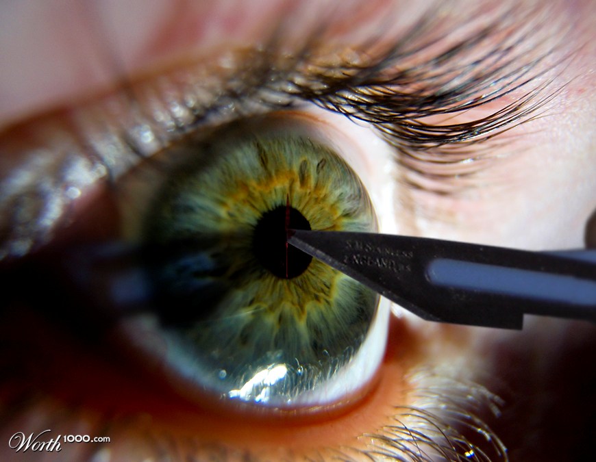 Open eye surgery