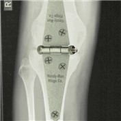 Knee Repair — motorhead