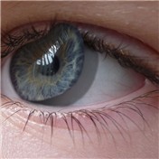 Raising Eye — vaughn91
