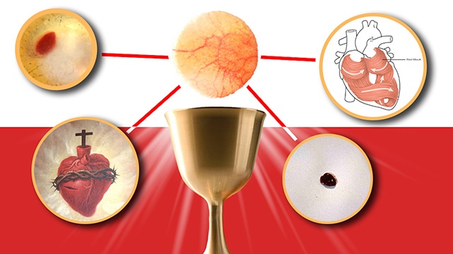 Eucharistic Miracle: Scientists Confirm Human Heart Tissue in Host