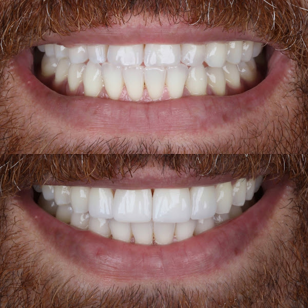 Foto 1 Allegra Odontologia - Metrô Tatuapé Foto 1 Allegra Odontologia - Metrô Tatuapé