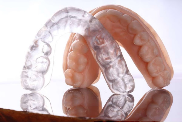 Foto 3 SB Odontologia Especializada - 40 anos - Dentista Pompéia - Dentista Perdizes- Implantes - Estética Dental - Facetas - Lente de Contato Dentais - Próteses - Botox - Cirurgia - Endodontia - Ortodontia Invisalign