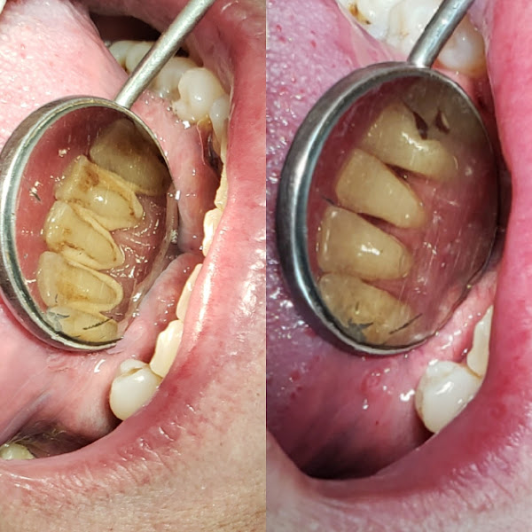 Foto 2 Consultório Odontológico MN Odontologia Integrada Foto 2 Consultório Odontológico MN Odontologia Integrada