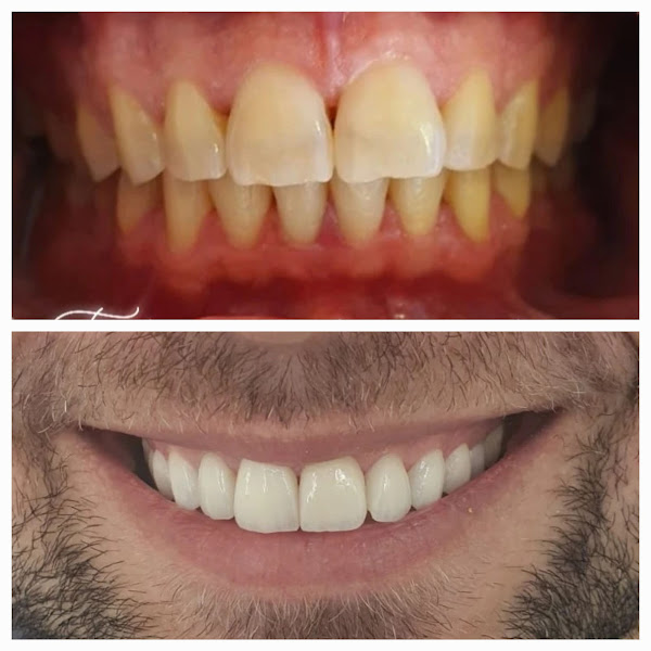 Foto 1 Dentista na Paulista Sakakura Odontologia - Harmonização Facial - Lente de Contato Dental SP - Clínica de Odontologia SP